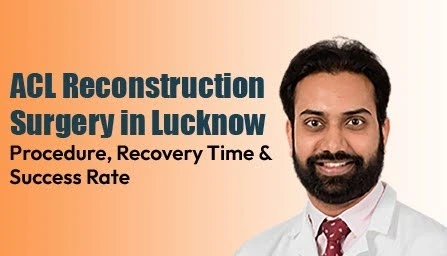 acl-reconstruction-surgery-lucknow