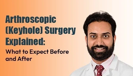arthroscopic-keyhole-surgery-before-after-guide