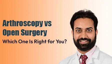 Arthroscopy