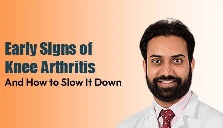 early-signs-of-knee-arthritis