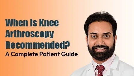 when-is-knee-arthroscopy-recommended